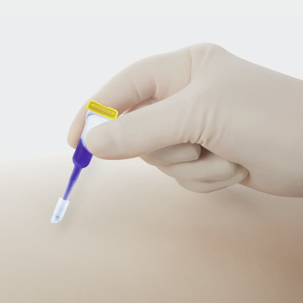 Histoacryl® Flexible blue handling-Tissue adhesive